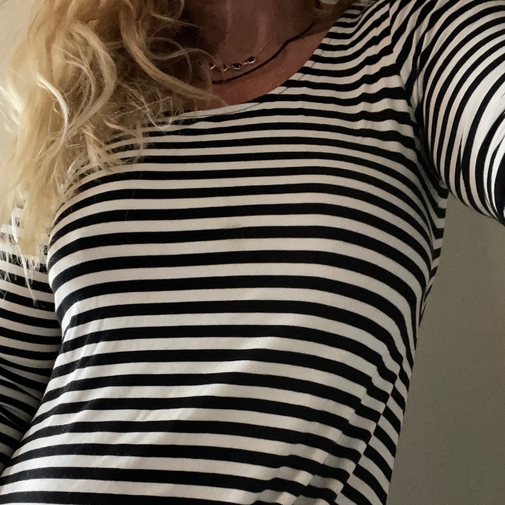 𝅺lovers and Friends NWOT black and white striped sexy dress cut out back.